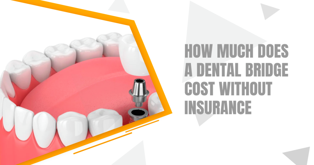 How Much Does A Dental Bridge Cost Without Insurance