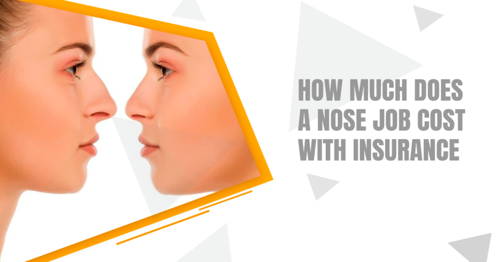 How Much Does A Nose Job Cost With Insurance